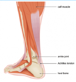 Calf muscle, Achilles tendon strains are preventable - Steven Chudik MD