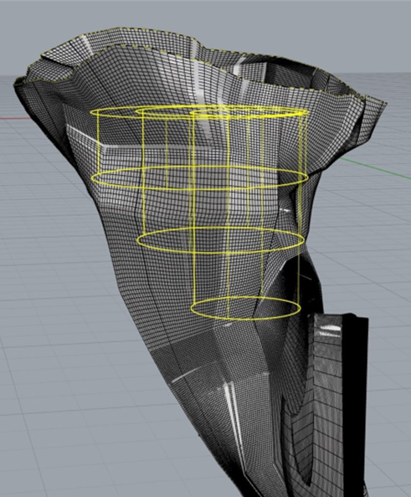 OTRF glenoid vault research published, presented for American Academy ...