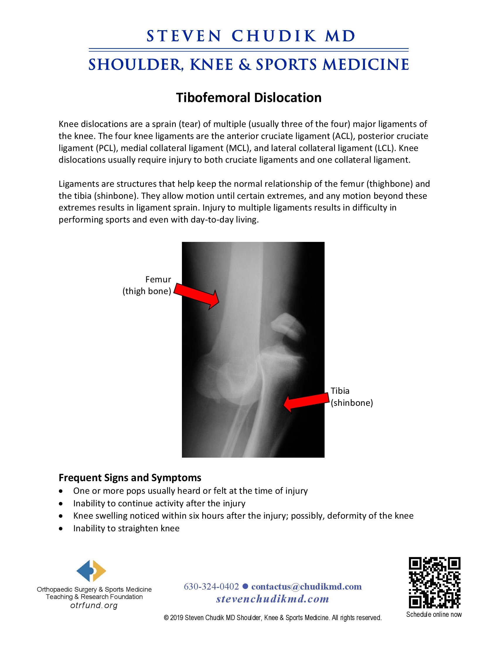 Knee (Tibiofemoral) Dislocation - Steven Chudik MD
