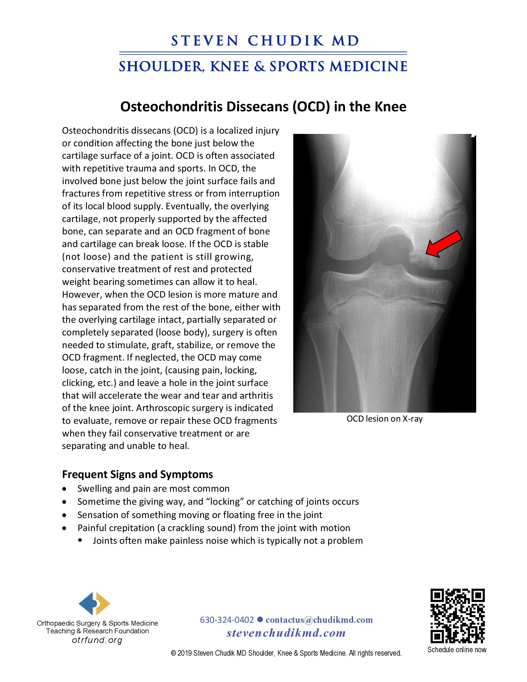 Osteochondritis Dissecans (OCD) - Steven Chudik MD