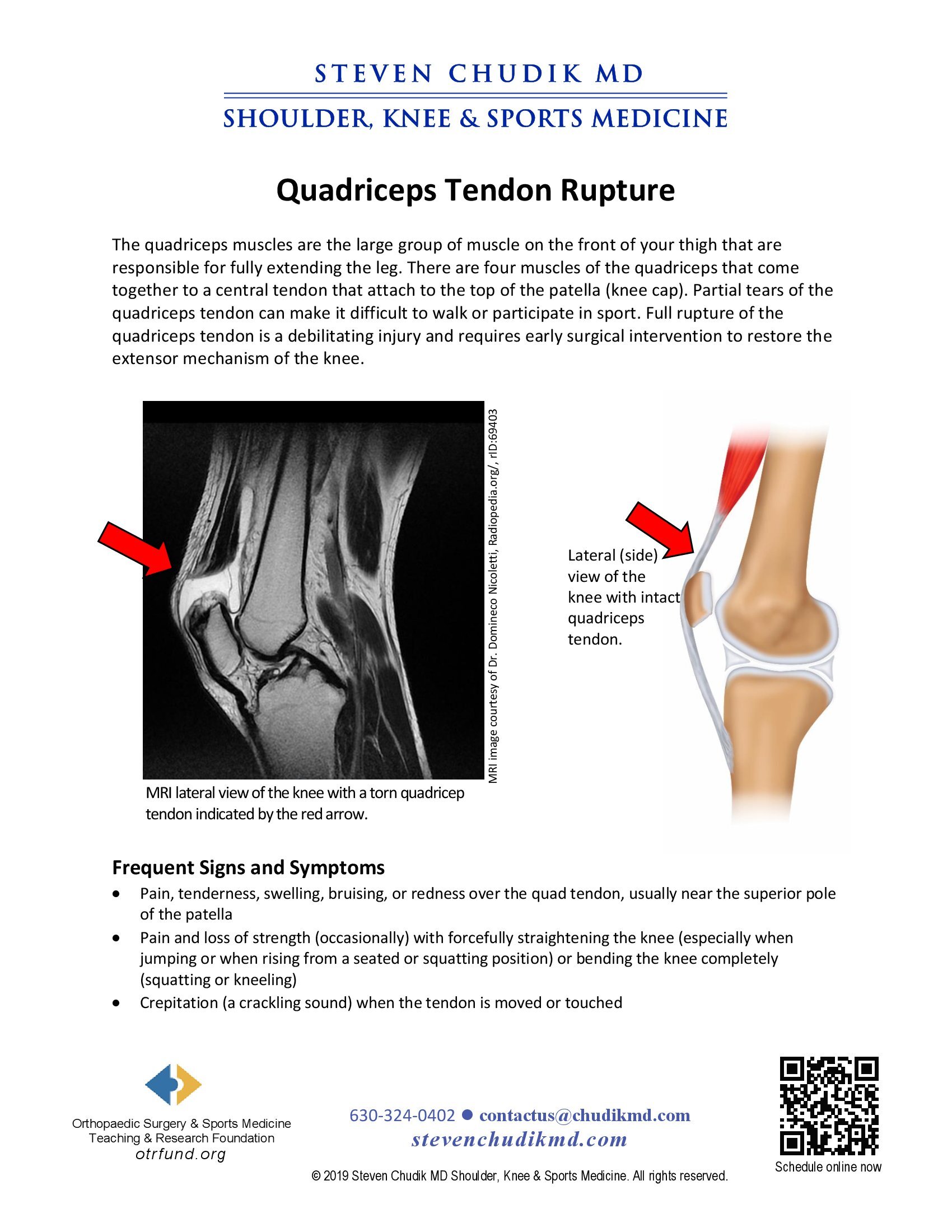 Quadriceps Tendon Rupture - Steven Chudik MD