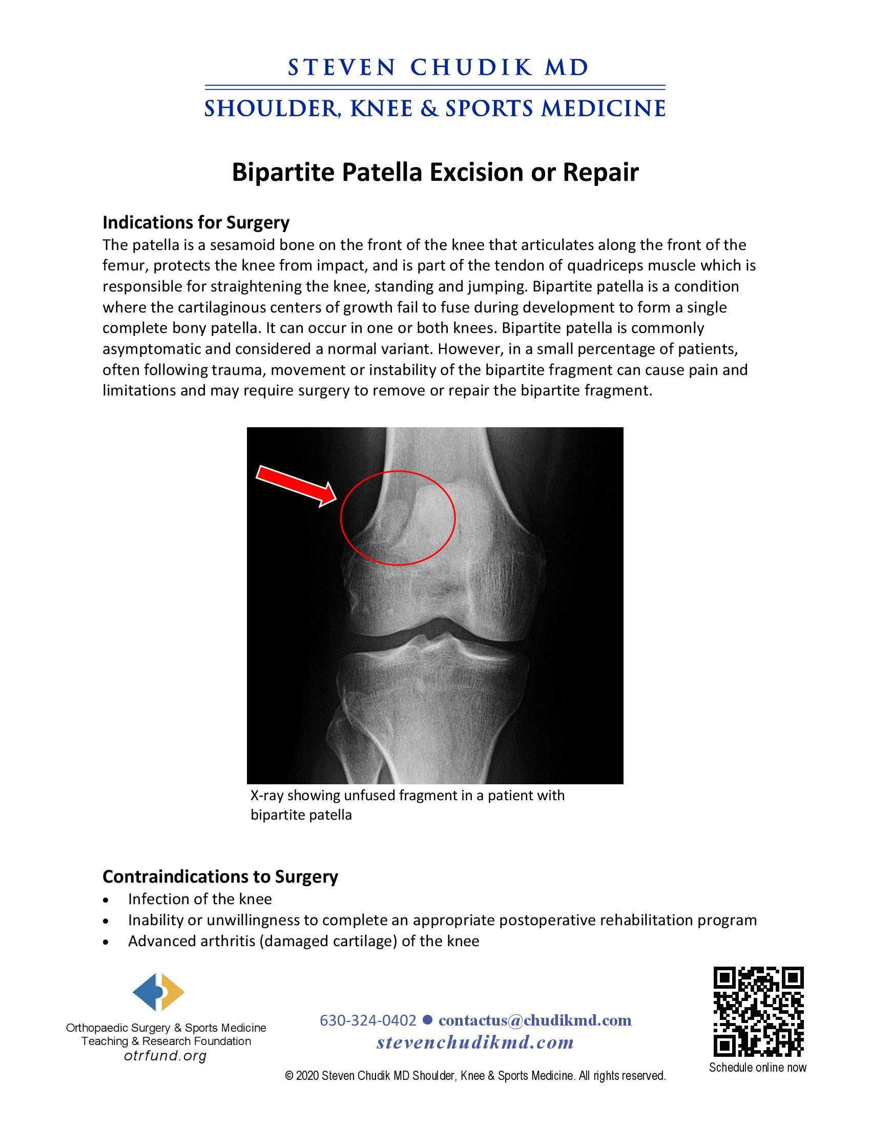 Bipartite Patella Excision or Repair - Steven Chudik MD