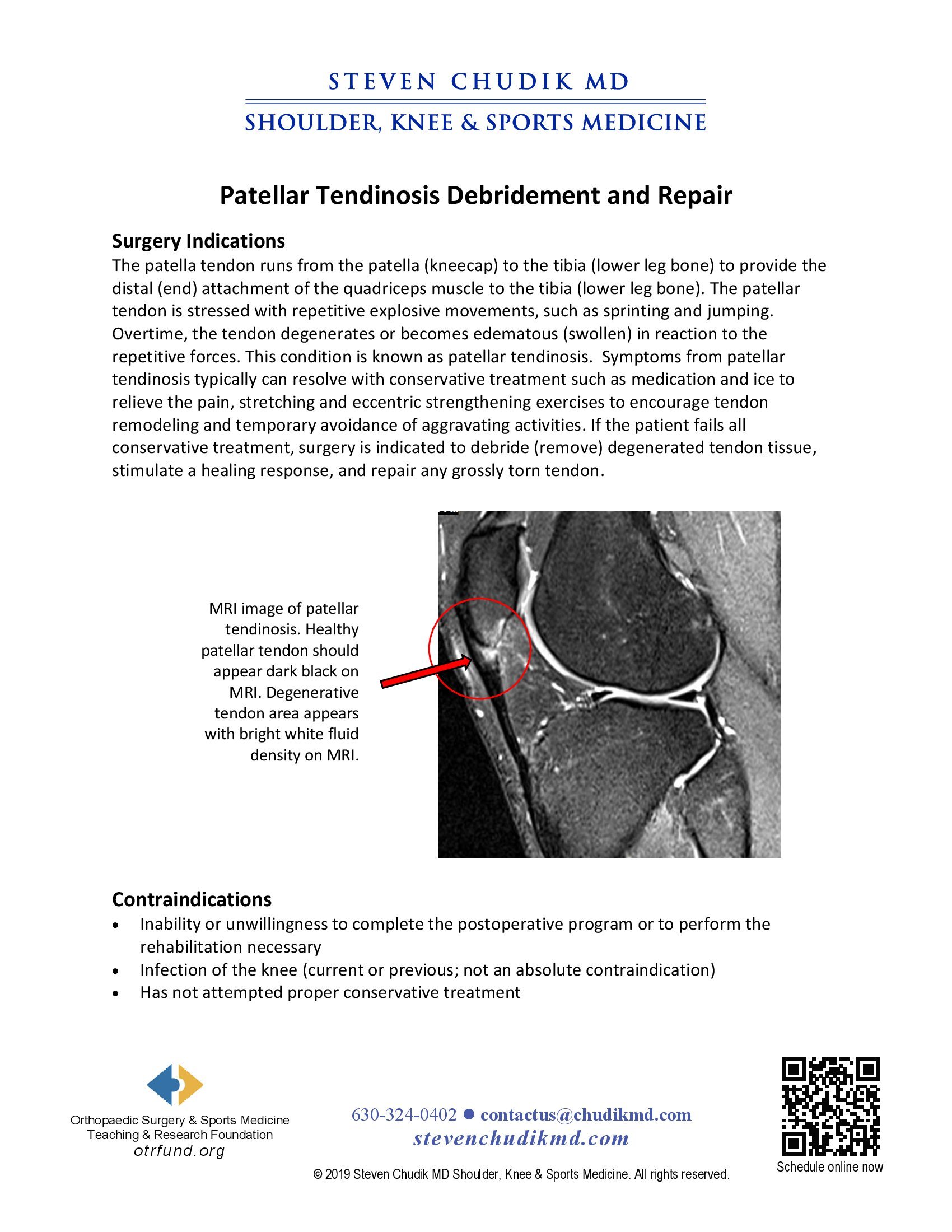 Patellar Tendinosis Debridement and Repair - Steven Chudik MD