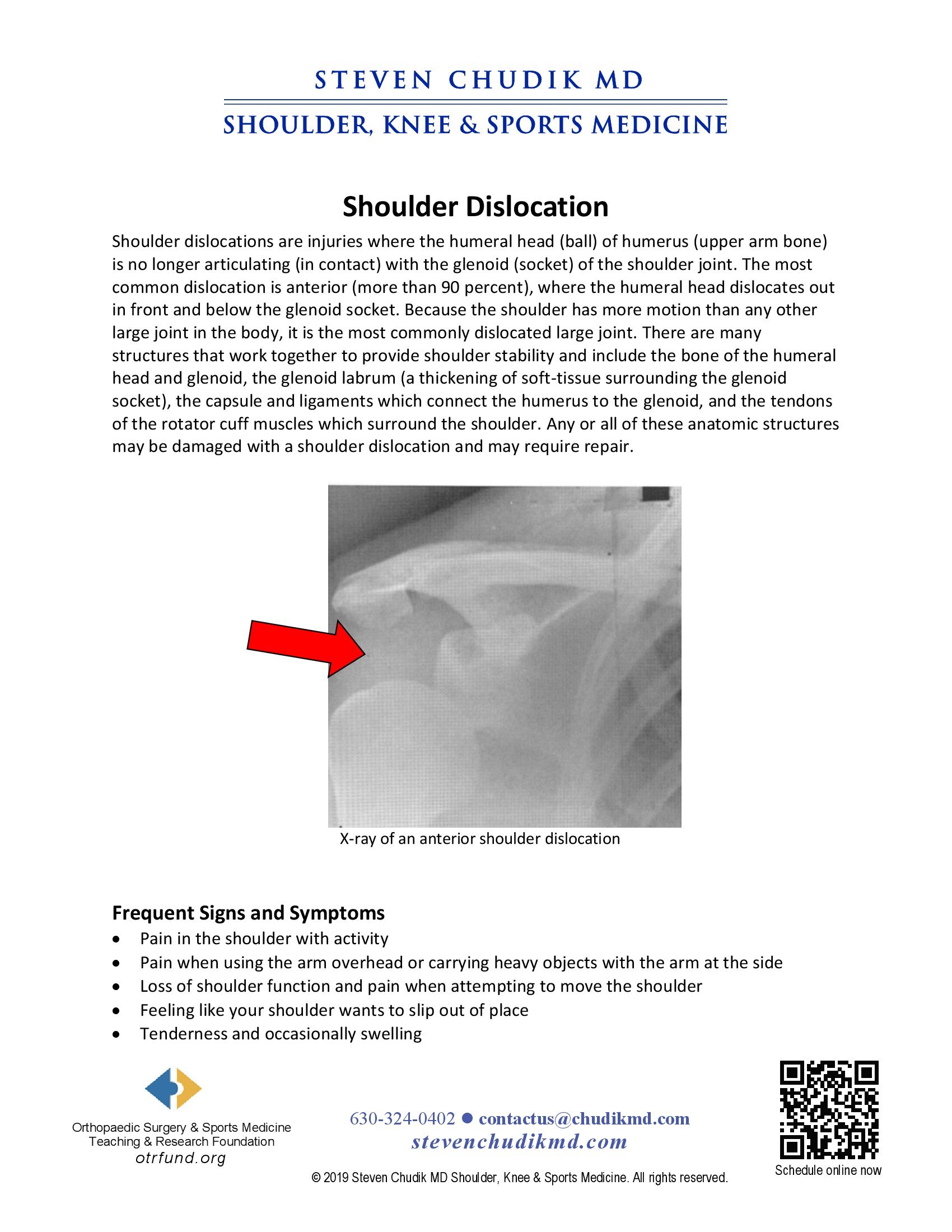 Shoulder Dislocation Steven Chudik Md 2768