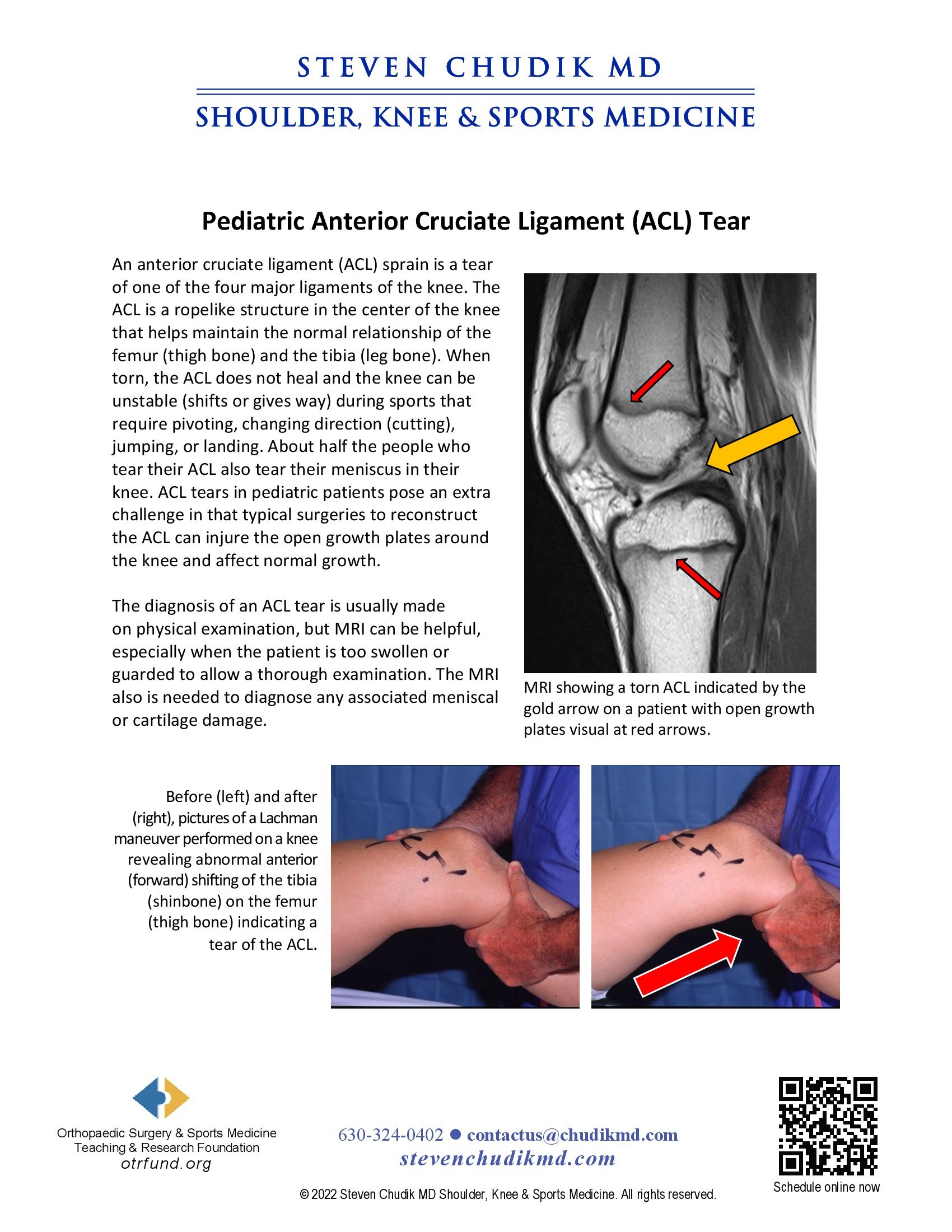 Pediatric Anterior Cruciate Ligament (ACL) Injuries - Steven Chudik MD