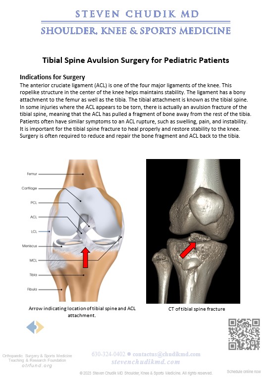 Arthroscopic Tibial Spine Avulsion Surgery for Pediatric Patients ...