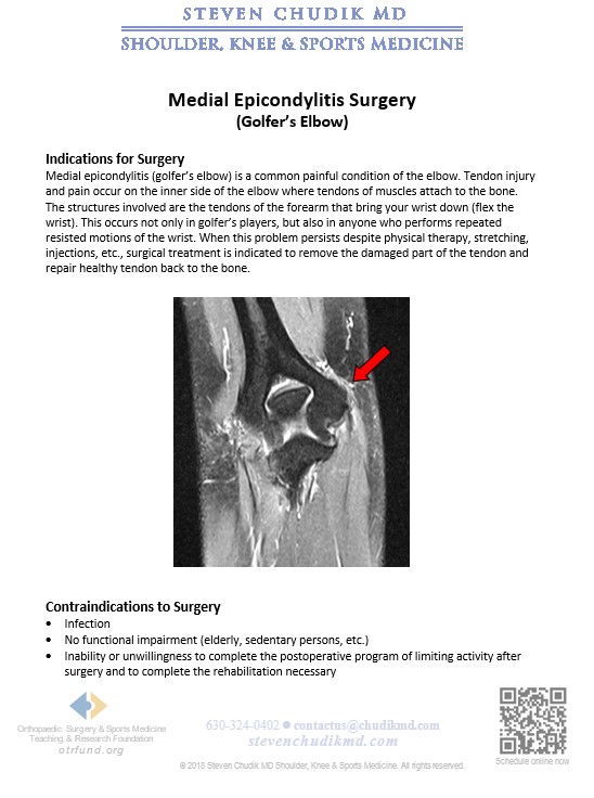 Medial Epicondylitis (Golfer’s elbow) - Steven Chudik MD