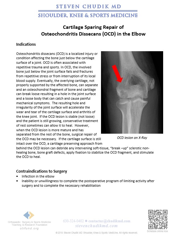 Osteochondritis dissecans (OCD) repair - Steven Chudik MD