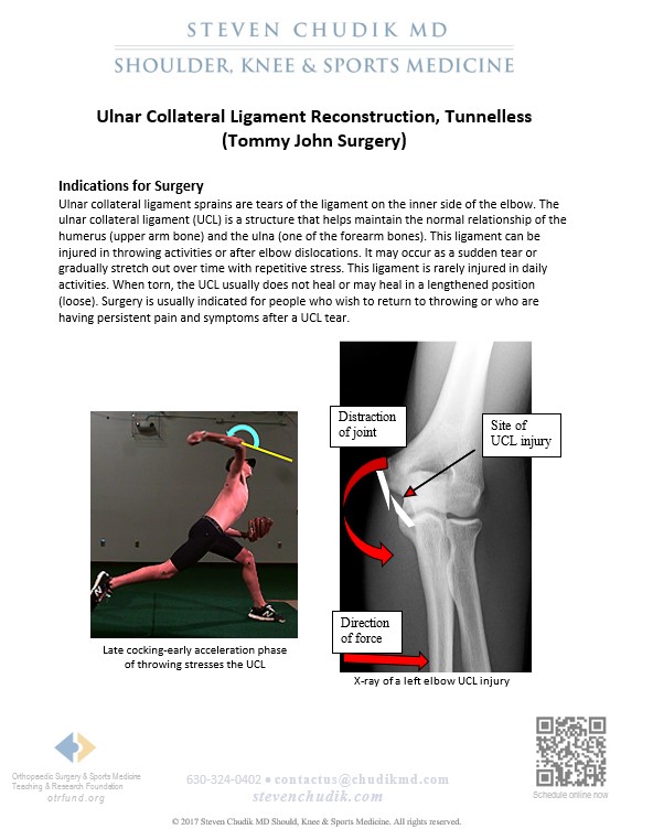 Medial Ulnar Collateral Ligament Repair And Reconstruction Tommy John Surgery Steven Chudik MD